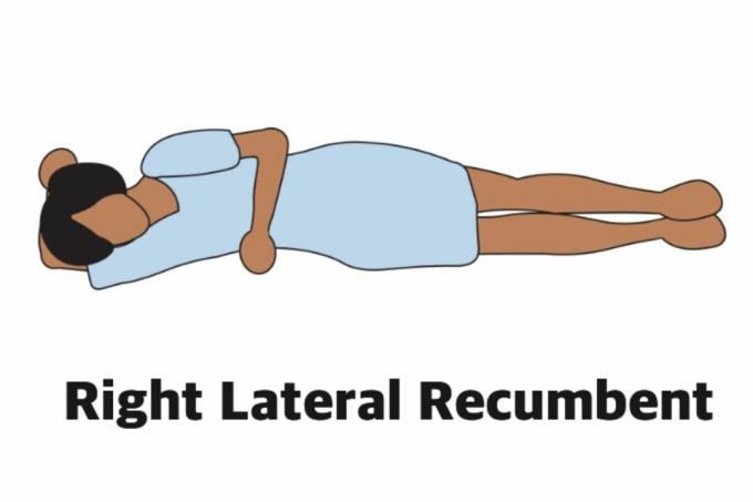 Right Lateral Recumbent