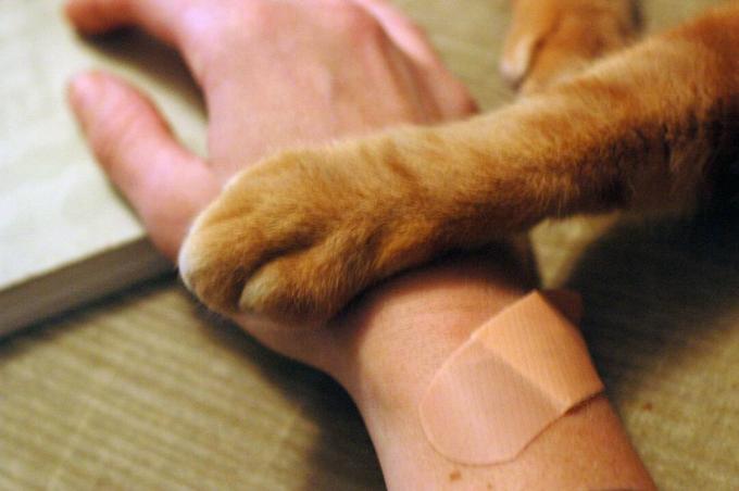 En bandasjert menneskehånd og en kattens tass.
